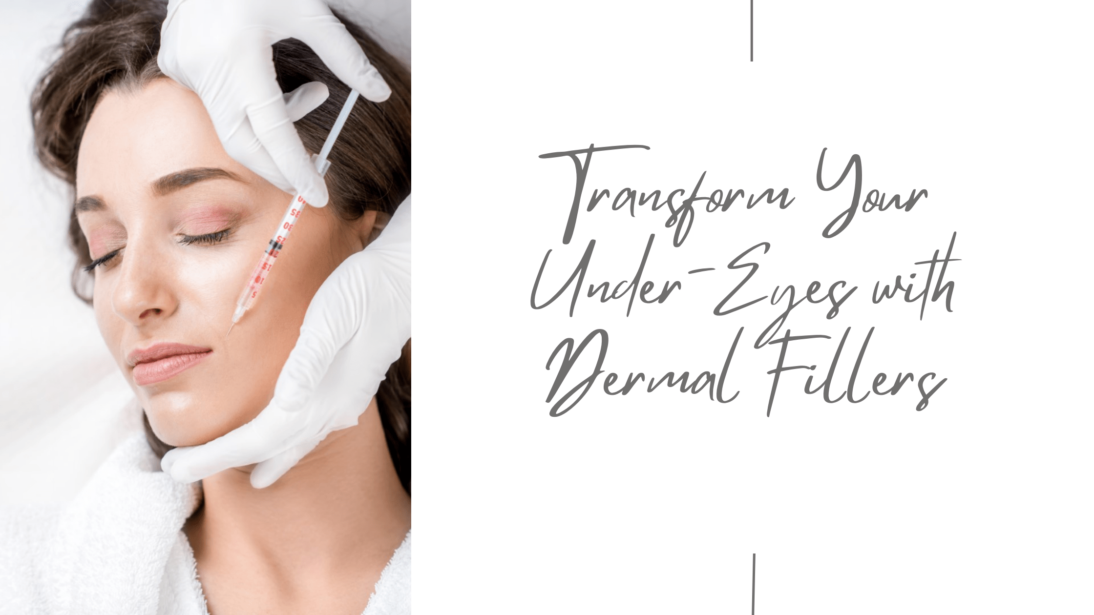 dermal fillers under eyes